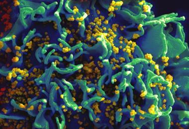 HIV-infected_H9_T_cell_(6813403685)
