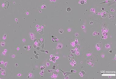 Low-Res_Cas12a2-induced cell death