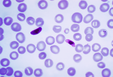 Plasmodium_falciparum_01 (1)