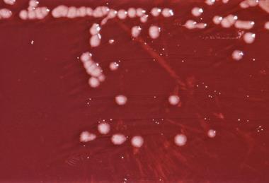 Pseudomonas_aeruginosa_01