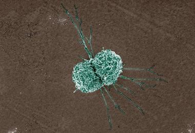 Macrophage_(17195150690)