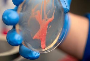 Low-Res_Ralstonia-Bacteria-UCD-28