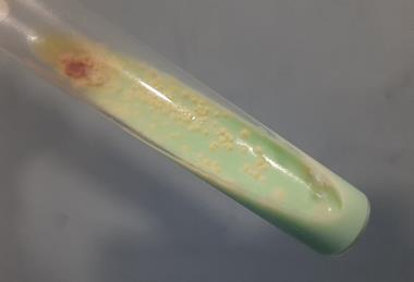 Mycobacterium_tuberculosis_growth_on_L-J_medium (1)