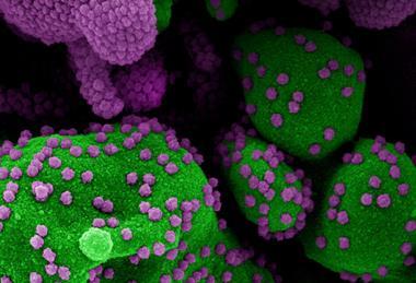 Novel_Coronavirus_SARS-Cov-2_(50011008502)