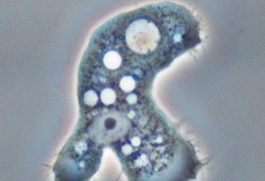 Parasite_Acanthamoeba keratitis