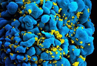 HIV-infected_T_cell_(6813384933)