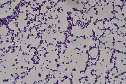 Staphylococcus_aureus_Gram_stain (2)