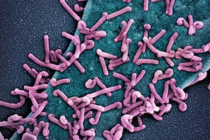 Marburg_virus_outbreak