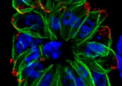 Humans_fibroblasts_infected_with_a_mutant_of_the_intracellular_parasite_Toxoplasma_gondii_-_image.pbio.v10.i12.g001