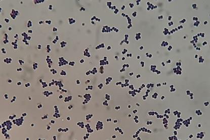 Leuconostoc_mesenteroides_Gram_Staining