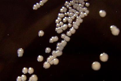 Bordetella_pertussis_on_Charcoal_Agar_supplemented_with_Cephalexin_-_Detail