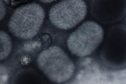 Molluscum_contagiousum_virus_(negative_staining)