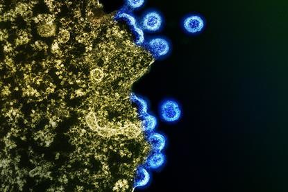 HIV_Virus_Particles_-_53567924670 (1)