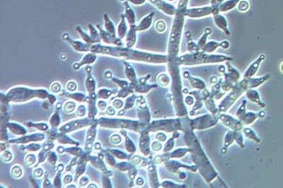 Trichoderma_harzianum
