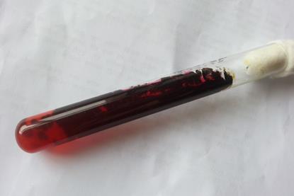 Ochroconis_gallopava_growth_on_SDA_after_4_days_of_incubation_showing_red_to_maroon_pigment_around_the_colony