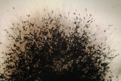 Aspergillus_fumigatus_microscope_view