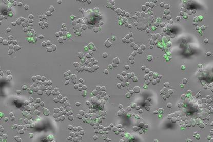 Low-Res_Mycobacterium tuberculosis (green) inside human immune cells known as macrophages