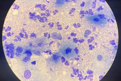 Chlamydia-22Feb25
