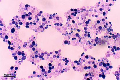 Candida_albicans_(248_35)