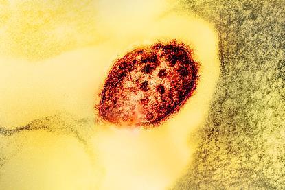 Measles_Virus_Particle