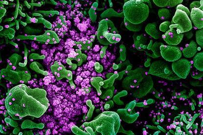 Novel_Coronavirus_SARS-CoV-2_(49666286236)