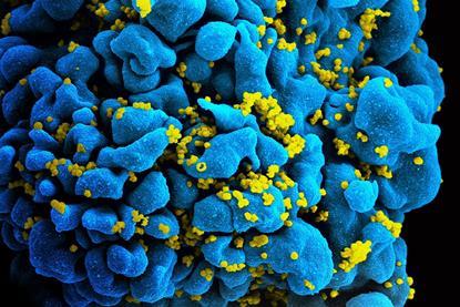 HIV-infected_T_cell_(6813384933)