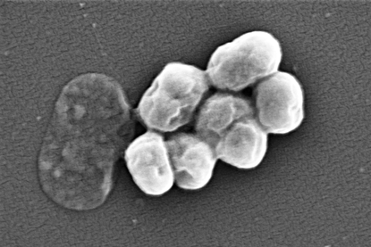 A.baumannii_visualized_using_Scanning_electron_microscopy
