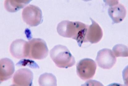 Plasmodium