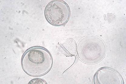 Coscinodiscus_granii