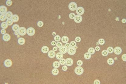 Cryptococcus_neoformans_using_a_light_India_ink_staining_preparation_PHIL_3771_lores (1)