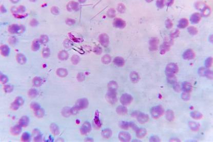 Plasmodium_falciparum_gametocyte