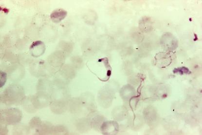 Trypanosoma blood