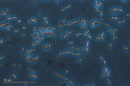 Lactobacillus_acidophilus_(259_09)_Lactobacillus_acidophilus_(Döderlein_bacillus)