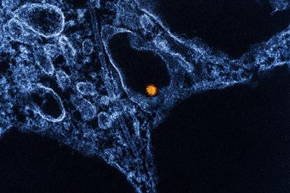 West_Nile_Virus_-_53865578133
