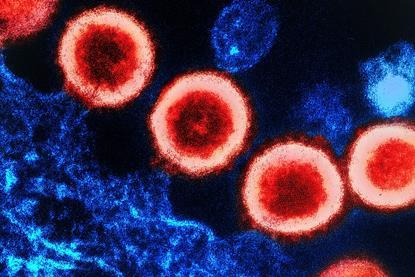 HIV-1_Virus_(52372037621)