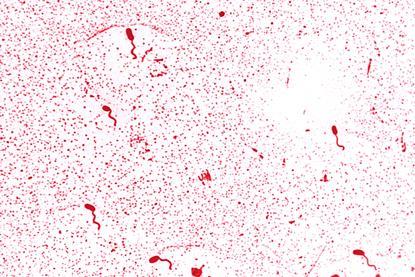 Vibrio_cholerae_01
