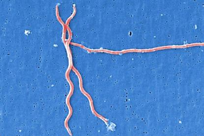 Lyme_disease_parasite_Borrelia_burgdorferi (1)