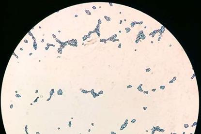 Saccharomyces_cerevisiae