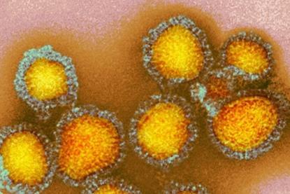 Colorful_photo_of_influenza_particles.webp