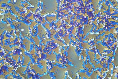 Eubacteria_(26_2_87)_Bacillus_subtilis;_spores_stained_green