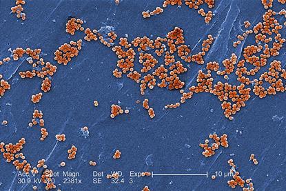 Methicillin-resistant_Staphylococcus_aureus_10048 (1)