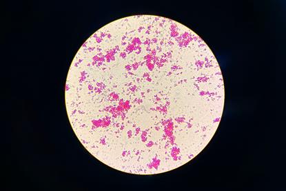 Nontuberculous_Mycobacteria_(NTM)_in_Ziehl-Neelsen_Staining_from_Positive_MGIT_Culture (1)