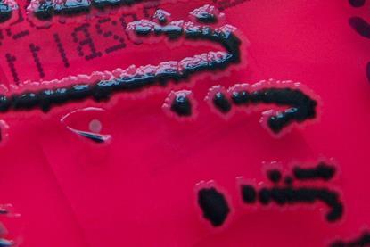 Salmonella_species_growing_on_XLD_agar_-_Showing_H2S_production_-_Detail