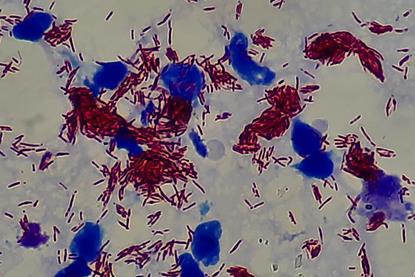 Mycobacterium_leprae_in_Magnification_of_4000X