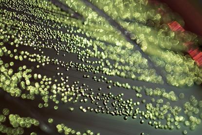 Escherichia_coli_EMB