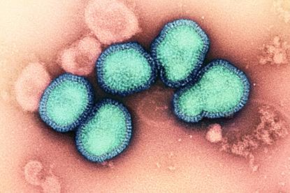 Influenza_A_Virus_(H3N2)_(52747881739)