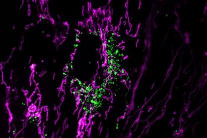 Low-Res_rehman-lab-mitokeima-hlmvec-oa-maggreen