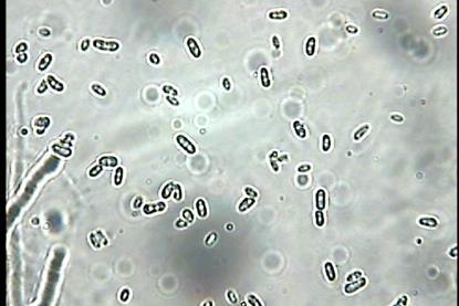 Микроконидии_од_Fusarium_sp