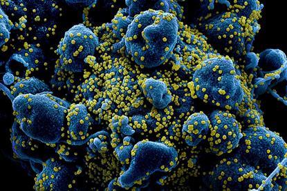 Novel_Coronavirus_SARS-CoV-2_(49680384281)