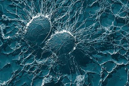 Staphylococcus_aureus,_50,000x,_USDA,_ARS,_EMU